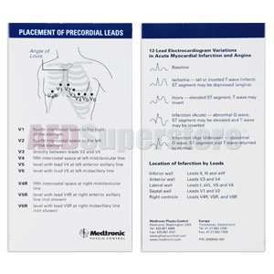  LIFEPAK 12 ECG Pocket Card Placement of Precordial Leads 