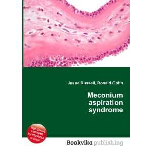  Meconium aspiration syndrome Ronald Cohn Jesse Russell 