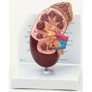  Kidney Model 