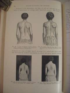 1908 HOWARD A. KELLY MEDICAL GYNECOLOGY PHOTOS DRAWINGS  