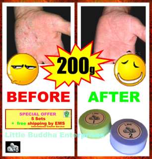 Get rid of Eczema *** 5 Sets Value Pack ***  